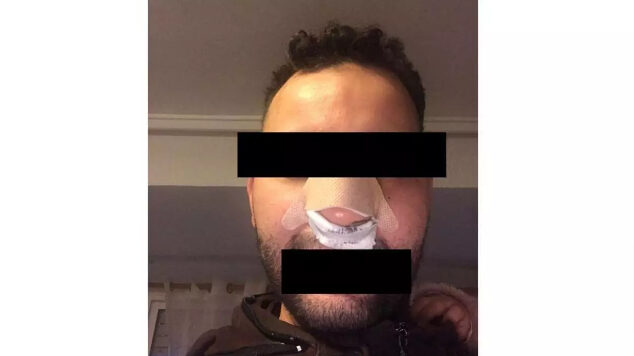 La Fiscalía pide tres años de cárcel a tres empleados de una discoteca de València por una agresión a un joven marroquí